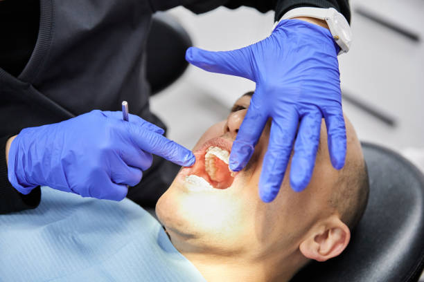 Best Emergency Treatment for Dental Infections or Abscesses in West Liberty, WV