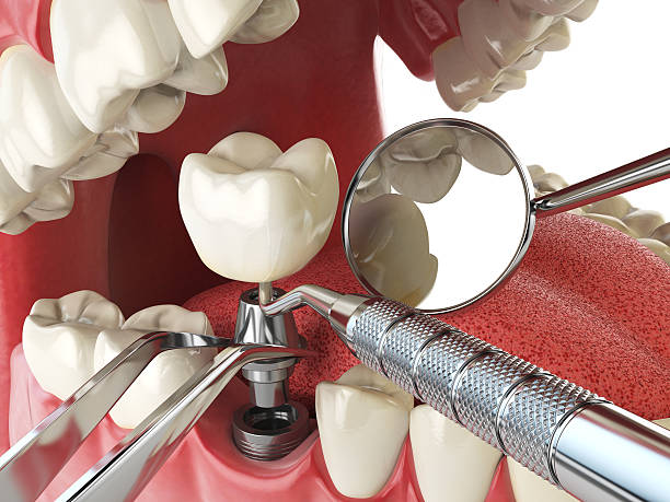 Best Same-Day Emergency Dental Services in West Liberty, WV
